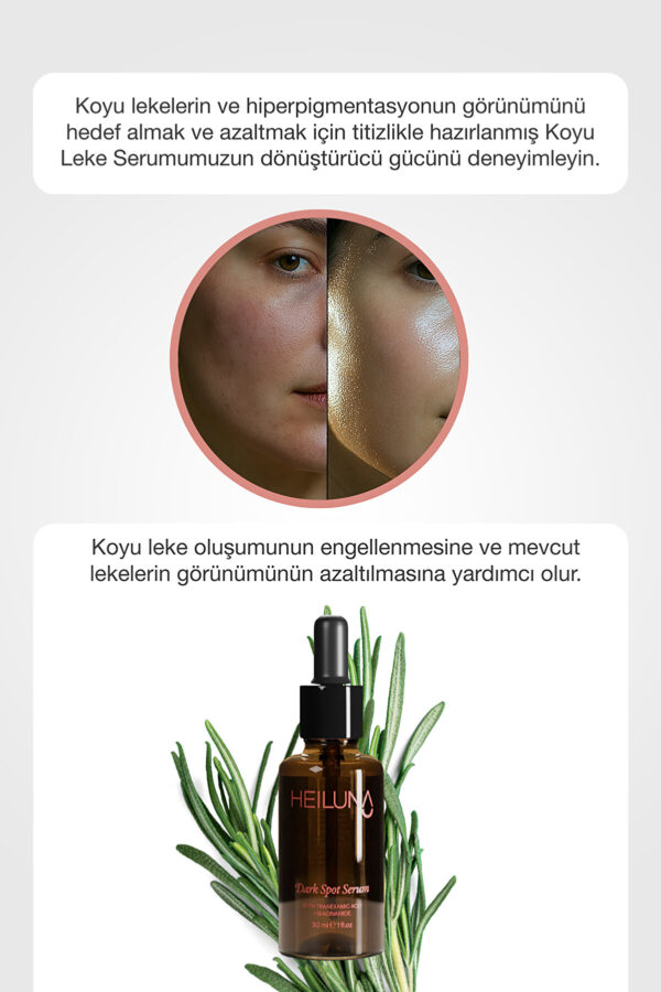 Koyu Leke Karşıtı Serum 30 ml Niacinamide ve Alpha-Arbutin ile Parlak, Eşit Tonda Cilt - Görsel 5