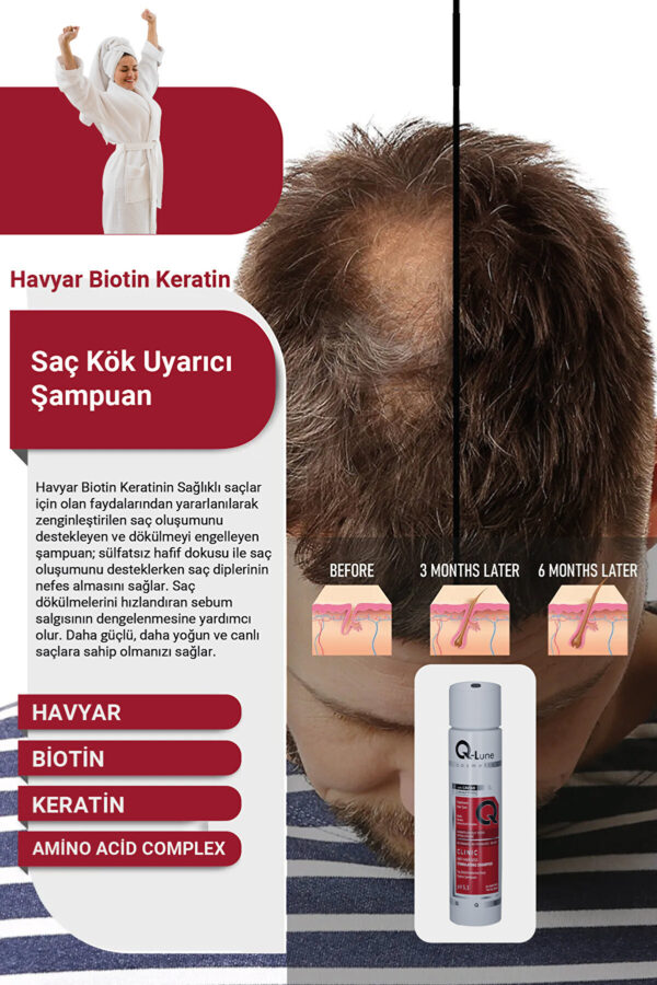 Biotin/havyar Özlü Kök Uyarici Klinik Şampuan 300ml (STİMULANT CLİNİCAL SHAMPOO) - Görsel 3